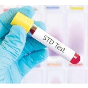 Chlamydia & Gonorrhoea STD Test Kit 