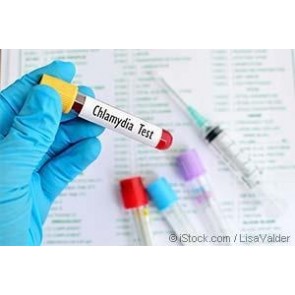 Chlamydia STD Testing Kit 