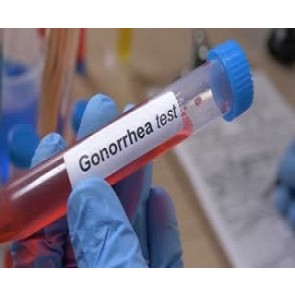 Gonorrhoea STD Test Kit 