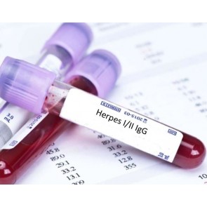 Herpes STD Test Kit 