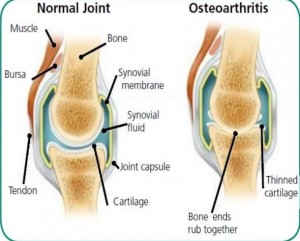 Joint comparison